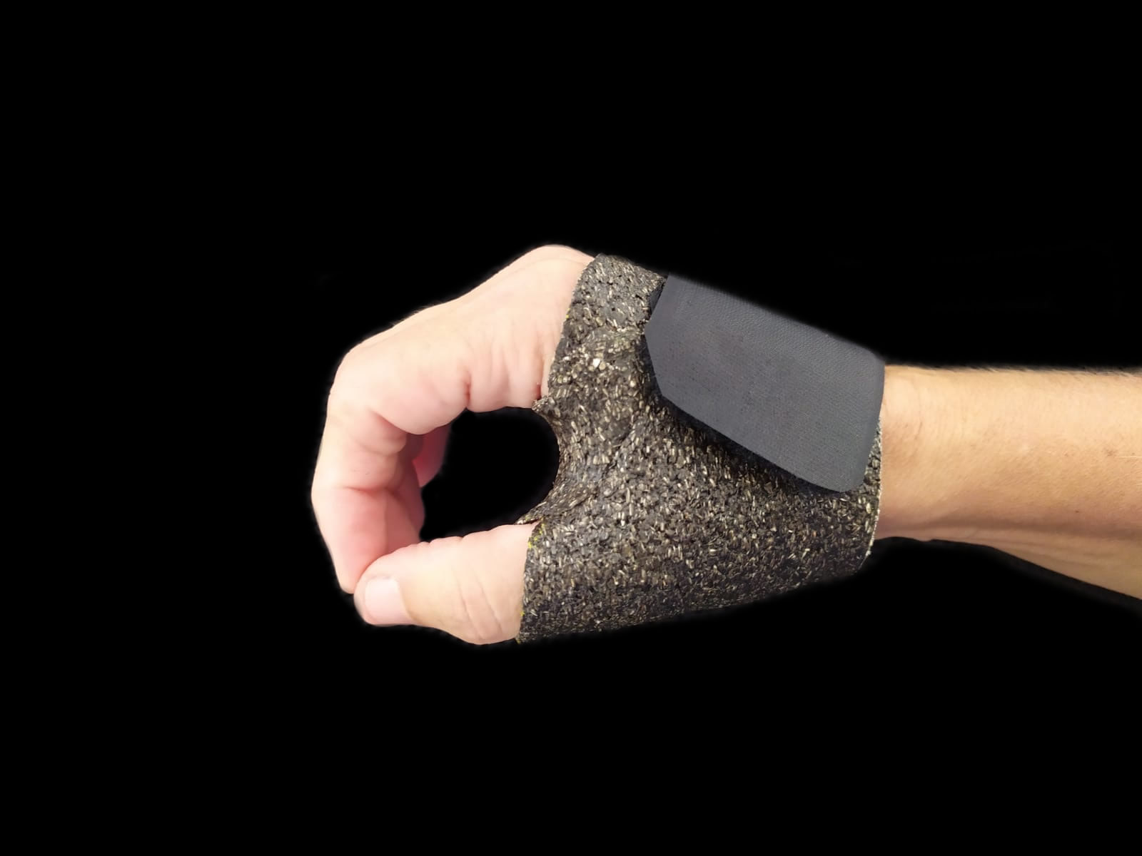 Custom made hand and wrist splints. Recommendations for proper use to avoid complications.